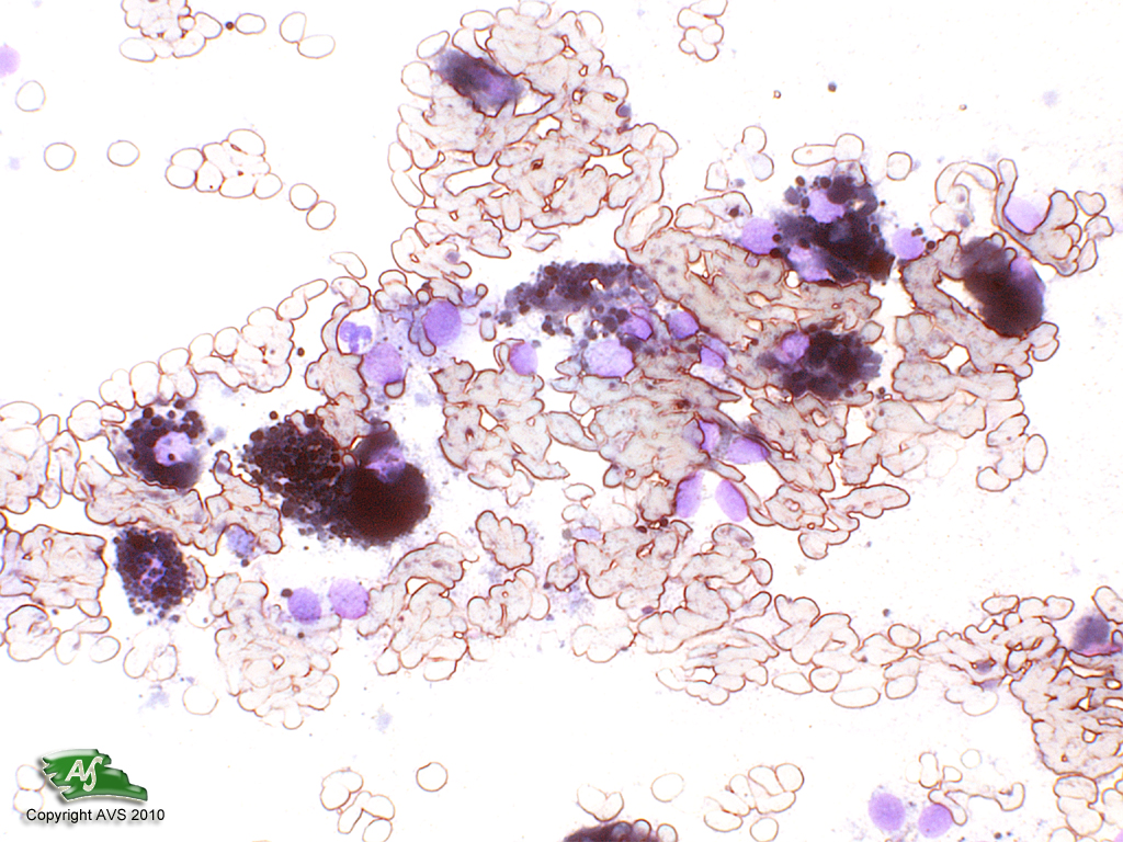 Dog, Skin: Melanoma (presumed melanocytoma) - Veterinary Pathology ...