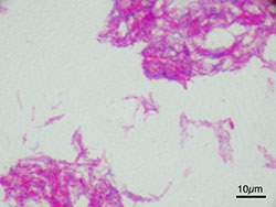 Mycoplasma bovis is becoming an increasingly significant pneumonia pathogen in cattle1.