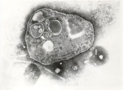 Photograph: Rinderpest virus, copyright held by dr. Rajnish Kaushik