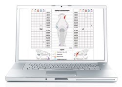 Virbac, in conjunction with the European Veterinary Dental Society, has launched an online dental charting system called the Electronic Veterinary Dental Scoring System for use by small animal practitioners. 