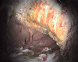 Zoetis has announced the launch of a digital tool to support veterinary surgeons with the diagnosis of Equine Gastric Ulceration Syndrome (EGUS).