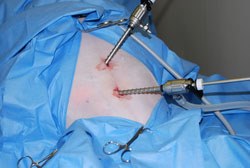 Freelance Surgical Ltd has announced a limited offer under which it will supply all of the instrumentation and capital equipment required for a veterinary practice to set up a new laparoscopy service, for £10,000 +VAT