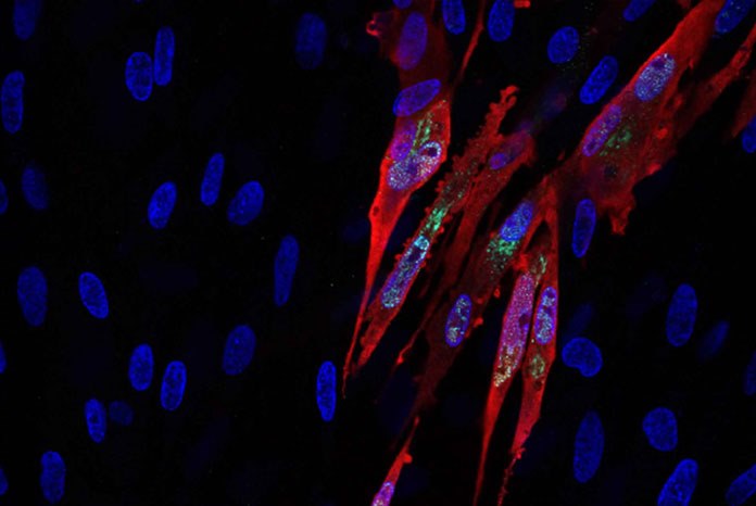 Cells infected with the Marek's disease vaccine virus, HVT, (green) expressing the inserted infectious bursal disease virus gene, VP2 (red). Cell nuclei are shown in blue. © Dr Na Tang, The Pirbright Institute 2018.